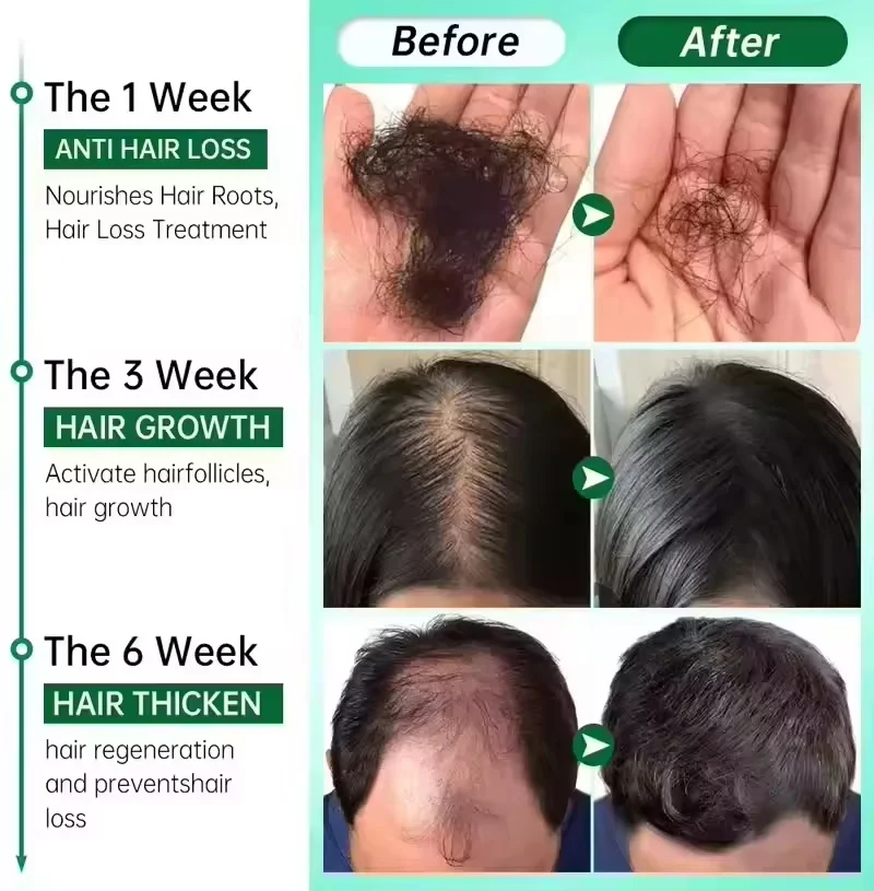 Fast Hair Growth Serum Spray Anti Hair Loss Prevent Baldness Scalp Treatment Repair Roots Beauty Health Hair Care For Men Women - Image 5