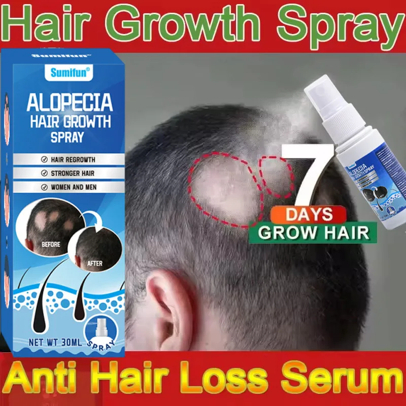 Fast Hair Growth Serum Spray Anti Hair Loss Prevent Baldness Scalp Treatment Repair Roots Beauty Health Hair Care For Men Women - Image 3