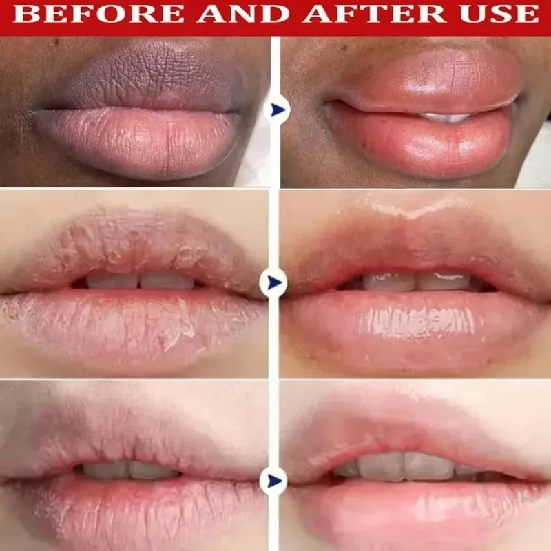 Fast Remove Dark Lip Balm Serum Lighten Melanin Lip Mask Exfoliating Fade Lip Lines Dead Skin Nourishing Repair Lip Care Makeup - Image 2