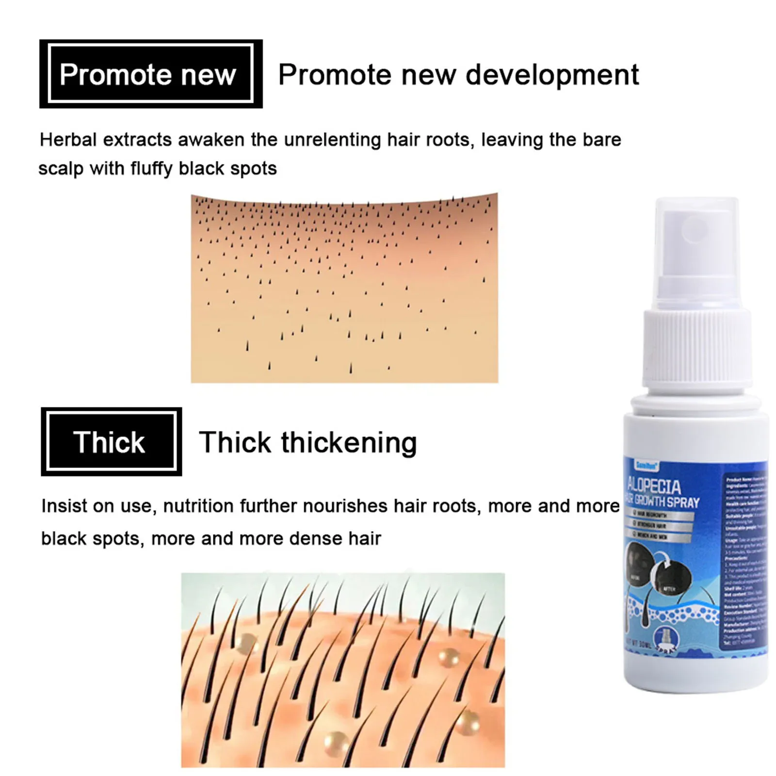 Fast Hair Growth Serum Spray Anti Hair Loss Prevent Baldness Scalp Treatment Repair Roots Beauty Health Hair Care For Men Women - Image 4