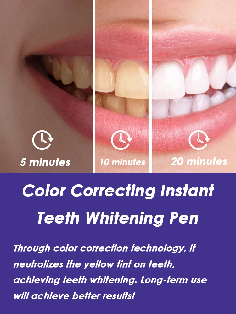No Sensitivity, All Brightness: Purple Instant Teeth Whitening Pen for Stain-Tartar Clean & Radiant Smile - Image 2