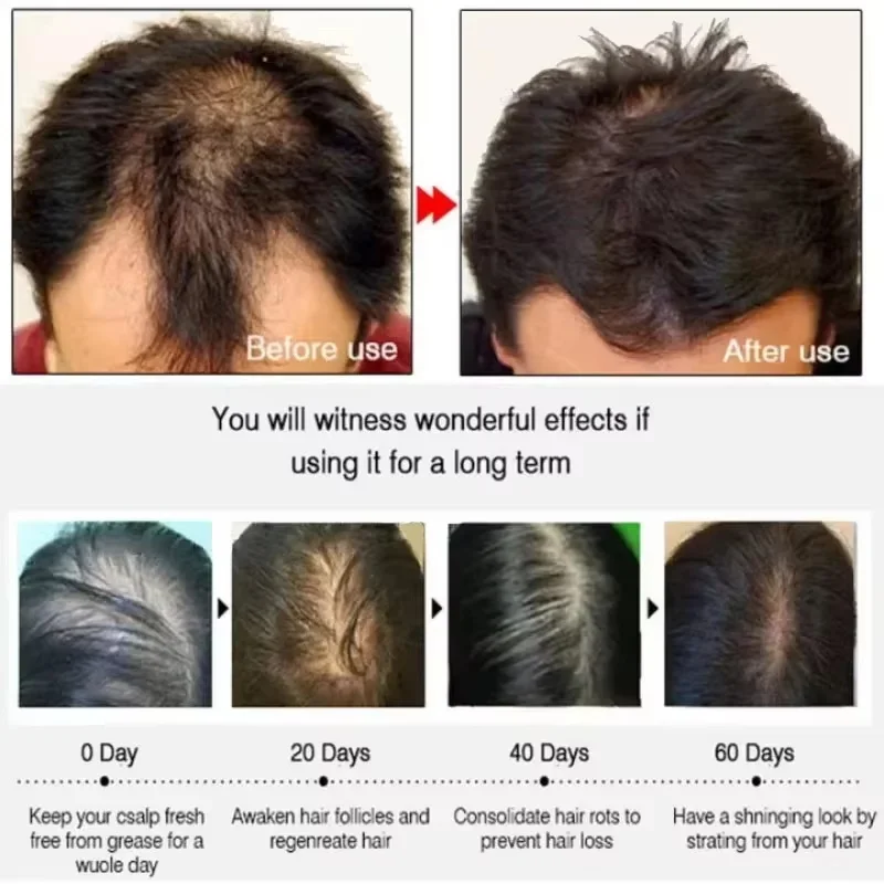 Fast Hair Growth Serum Spray Anti Hair Loss Prevent Baldness Scalp Treatment Repair Roots Beauty Health Hair Care For Men Women - Image 2